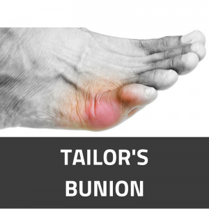Tailor's Bunion