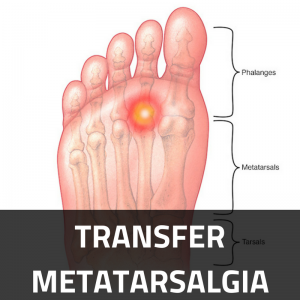 Transfer Metatarsalgia