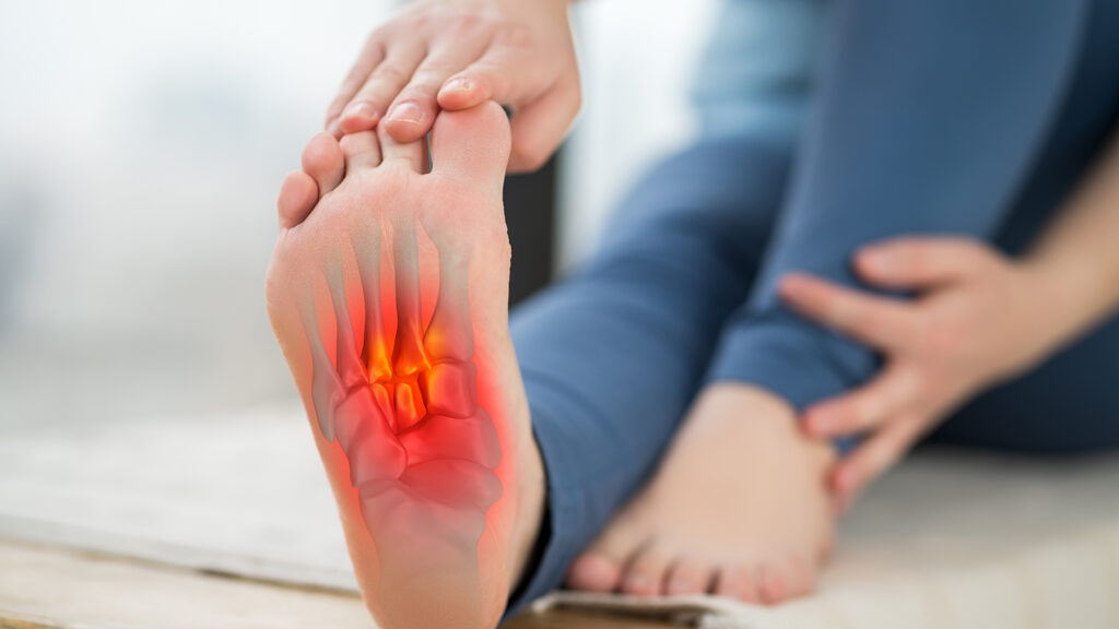 Plantar fasciitis